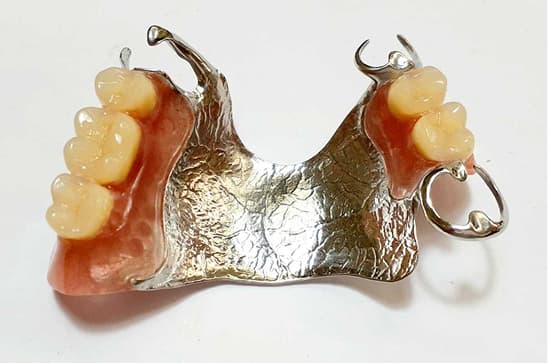 治療用入れ歯で口腔内を正常化